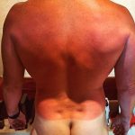 Chris Pratt Instagram Sonnenbrand nackt