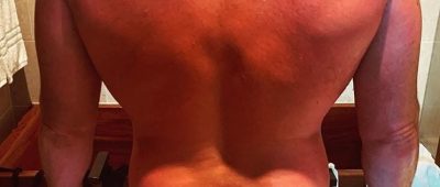 Chris Pratt Instagram Sonnenbrand nackt