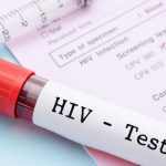 HIV-Test Aids-Test HIV