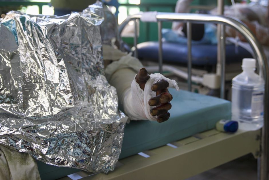 Haiti Explosion Krankenhaus Verbrannter