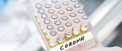 Corona PCR-Tests